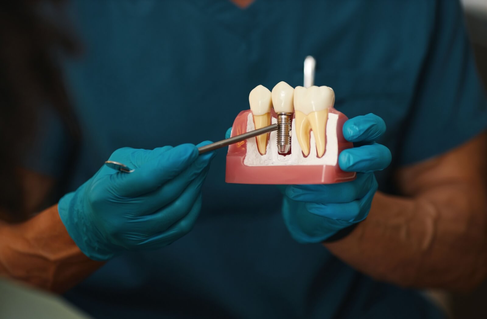 A dentist points to the titanium post of an anatomical dental implant model.